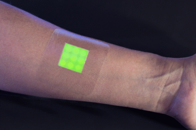 Intelligent Dressing Glows when Wounds are Infected