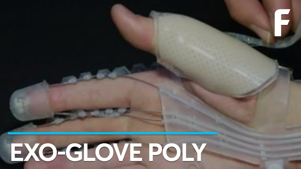 Regain Hand Function with this Incredible Glove