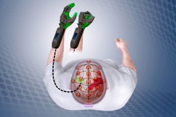 Mind Controlled Device Helps Stroke Patients Retrain Brain to Move Paralyzed Hands